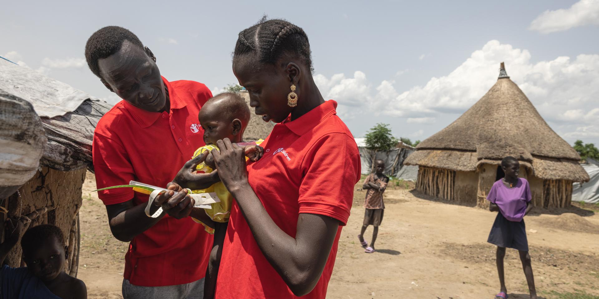 Due operatori visitano un bambino di 1 anno affetto da malnutrizione, in Sud Sudan